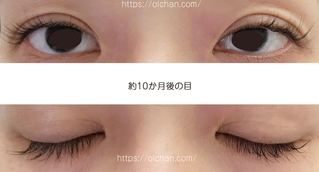 約10か月後の目